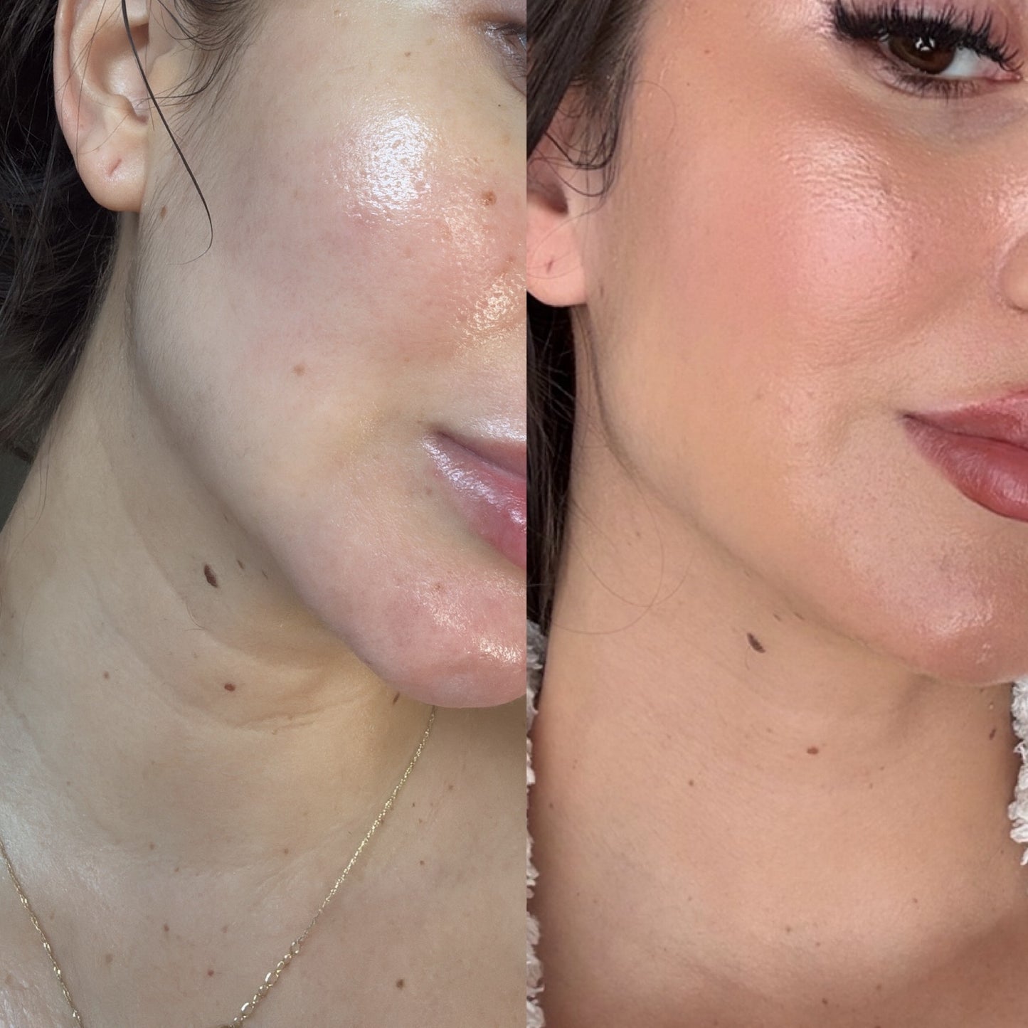 Krx Neck Lift Intensive firming cream