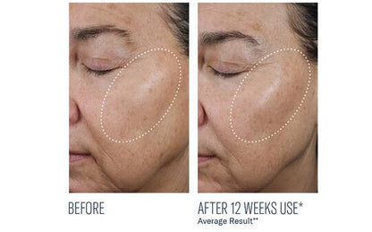 Ampra Volumizing Macro Serum