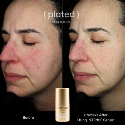 Plated Intense Serum