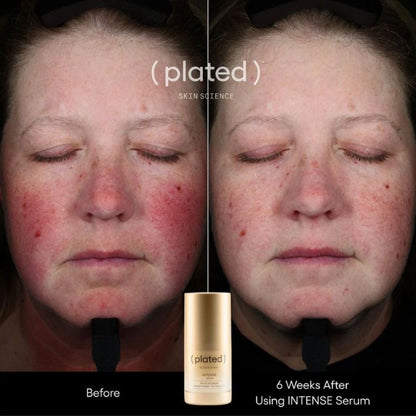 Plated Intense Serum